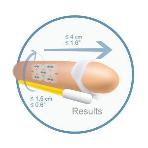 EXTENSOR DE PÉNIS POR TRAÇÃO ANDROPÉNIS - Image 4
