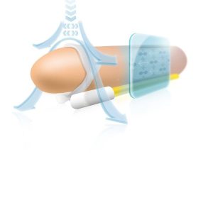 EXTENSOR DE PÉNIS POR TRAÇÃO ANDROPENIS MINI - Image 5